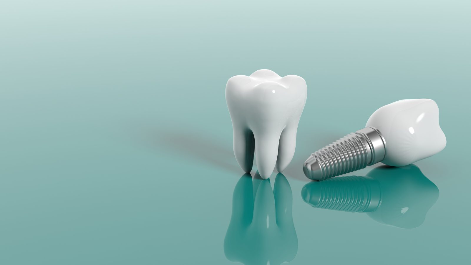 ¿Cuánto cuesta un implante dental?